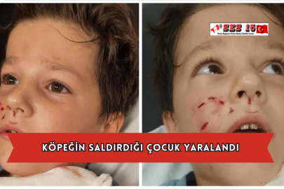 Köpeğin Saldırdığı Çocuk Yaralandı