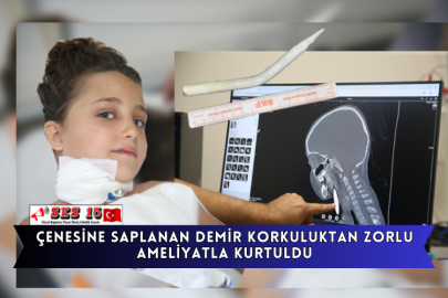 Çenesine Saplanan Demir Korkuluktan Zorlu Ameliyatla Kurtuldu