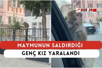 Maymunun Saldırdığı Genç Kız Yaralandı