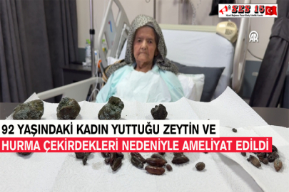 92 Yaşındaki Kadın Yuttuğu Zeytin Ve Hurma Çekirdekleri Nedeniyle Ameliyat Edildi