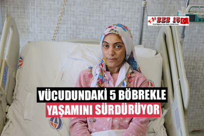 Vücudundaki 5 Böbrekle Yaşamını Sürdürüyor