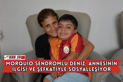 Morquio Sendromlu Deniz, Annesinin İlgisi ve Şefkatiyle Sosyalleşiyor