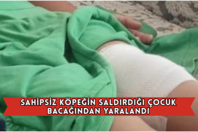 Sahipsiz Köpeğin Saldırdığı Çocuk Bacağından Yaralandı
