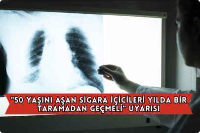 "50 Yaşını Aşan Sigara İçicileri Yılda Bir Taramadan Geçmeli" Uyarısı