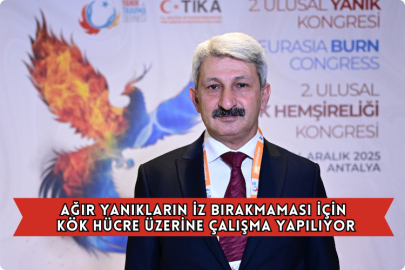 Ağır Yanıkların İz Bırakmaması İçin Kök Hücre Üzerine Çalışma Yapılıyor