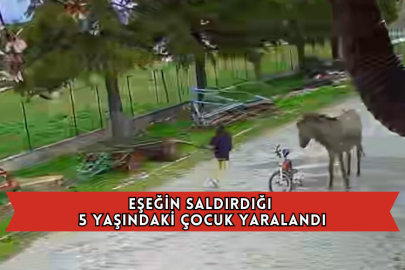 Eşeğin Saldırdığı 5 Yaşındaki Çocuk Yaralandı