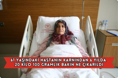 61 Yaşındaki Hastanın Karnından 6 Yılda 20 Kilo 100 Gramlık Bakın Ne Çıkarıldı